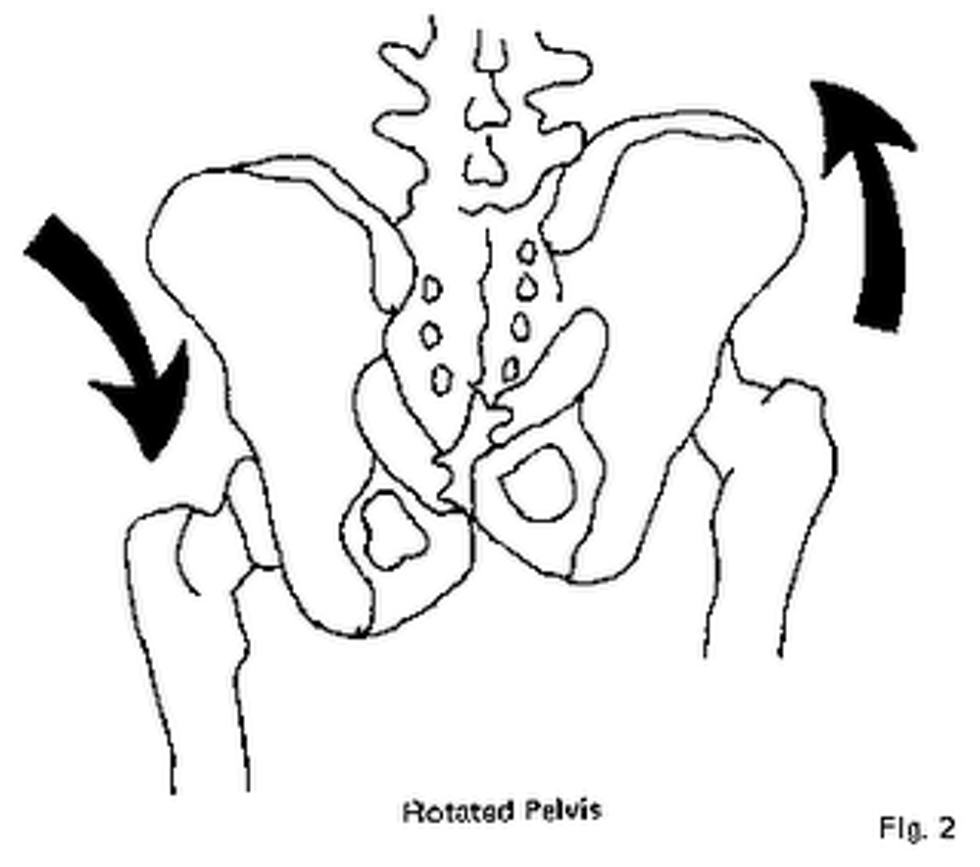 c9a709cc_rot-pelvis.png
